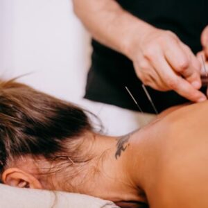 Acupuncture for the Treatment of Sports Injuries - 2 Chiropractic CE Hours