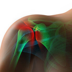 Analyzing the Rotator Cuff - 12 Chiropractic CE Hours