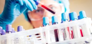 Chiropractic Guide to the Most Common Blood Tests - 5 Chiropractic CE Credits