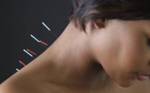 Iowa Acupuncture Chiropractic CE 12 Credit Hour Savings Package