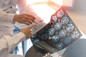 Multiple Sclerosis - Essential Topics - 4 Chiropractic CE