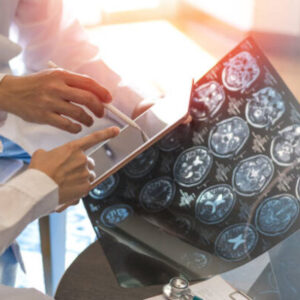 Multiple Sclerosis - Essential Topics - 4 Chiropractic CE