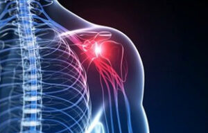 Rotator-Cuff-Part-1