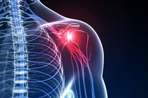 Rotator-Cuff-Part-1