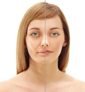 Understanding Bell's Palsy - 2 Chiropractic CE Credits