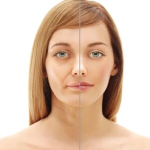Understanding Bell's Palsy - 2 Chiropractic CE Credits