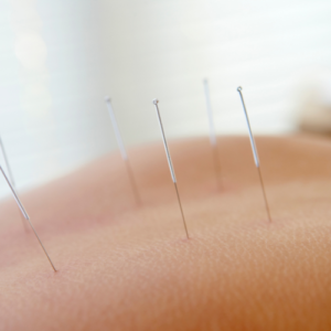 Utah Acupuncture Courses 10 Credit Hour Savings Package