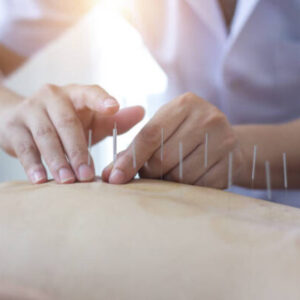 Acupuncture for Fibromyalgia & Chronic Fatigue - 2 Chiropractic CE