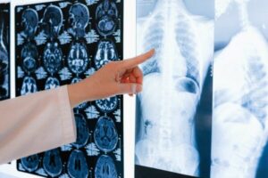 X-Ray Imaging Part C Course - 2 Chiropractic CE Hours